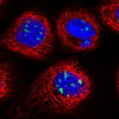 Anti-DDX27 antibody produced in rabbit Prestige Antibodies® Powered by Atlas Antibodies, affinity isolated antibody, buffered aqueous glycerol solution