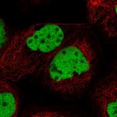 Anti-U2AF1 antibody produced in rabbit Prestige Antibodies® Powered by Atlas Antibodies, affinity isolated antibody, buffered aqueous glycerol solution