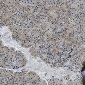 Anti-DIAPH2 antibody produced in rabbit Prestige Antibodies® Powered by Atlas Antibodies, affinity isolated antibody, buffered aqueous glycerol solution