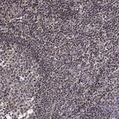 Anti-ACOT13 antibody produced in rabbit Prestige Antibodies® Powered by Atlas Antibodies, affinity isolated antibody, buffered aqueous glycerol solution
