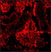 Anti-IRF3 antibody produced in rabbit affinity isolated antibody, buffered aqueous solution