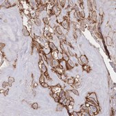 Anti-F11R antibody produced in rabbit Prestige Antibodies® Powered by Atlas Antibodies, affinity isolated antibody, buffered aqueous glycerol solution