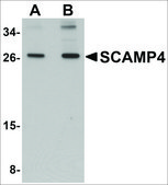 Anti-SCAMP4 antibody produced in rabbit affinity isolated antibody, buffered aqueous solution