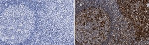 Anti-Calnexin Antibody, clone 10N19, ZooMAb® Rabbit Monoclonal recombinant, expressed in HEK 293 cells
