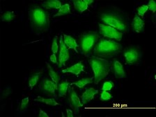 Monoclonal Anti-ABL2 antibody produced in mouse clone 5C6, purified immunoglobulin, buffered aqueous solution