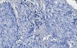 Anti-ARNT Antibody, clone 1H2 ZooMAb® Rabbit Monoclonal recombinant, expressed in HEK 293 cells