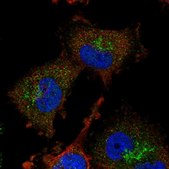 Anti-ADI1 antibody produced in rabbit Prestige Antibodies® Powered by Atlas Antibodies, affinity isolated antibody, buffered aqueous glycerol solution
