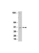 Anti-SUV39H1 Antibody Upstate®, from rabbit