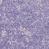 Anti-PLCD4 antibody produced in rabbit Prestige Antibodies® Powered by Atlas Antibodies, affinity isolated antibody, buffered aqueous glycerol solution