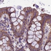 Anti-DUS2 antibody produced in rabbit Prestige Antibodies® Powered by Atlas Antibodies, affinity isolated antibody, buffered aqueous glycerol solution