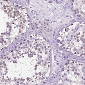 Anti-SPDYA antibody produced in rabbit Prestige Antibodies® Powered by Atlas Antibodies, affinity isolated antibody, buffered aqueous glycerol solution