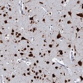 Anti-CELF2 antibody produced in rabbit Prestige Antibodies® Powered by Atlas Antibodies, affinity isolated antibody, buffered aqueous glycerol solution