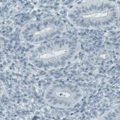 Monoclonal Anti-SLC27A5 antibody produced in mouse Prestige Antibodies® Powered by Atlas Antibodies, clone CL0216, purified immunoglobulin, buffered aqueous glycerol solution