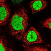 Anti-UBA2 antibody produced in rabbit Prestige Antibodies® Powered by Atlas Antibodies, affinity isolated antibody, buffered aqueous glycerol solution