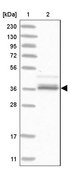 Anti-AKR1A1 antibody produced in rabbit Prestige Antibodies® Powered by Atlas Antibodies, affinity isolated antibody, buffered aqueous glycerol solution