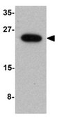 Anti-TRIM5 delta Antibody from rabbit, purified by affinity chromatography