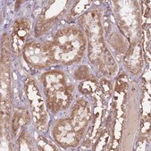 Anti-EMC1 antibody produced in rabbit Prestige Antibodies® Powered by Atlas Antibodies, affinity isolated antibody, buffered aqueous glycerol solution