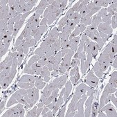 Anti-PSMD2 antibody produced in rabbit Prestige Antibodies® Powered by Atlas Antibodies, affinity isolated antibody, buffered aqueous glycerol solution