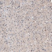 Anti-RCOR2 antibody produced in rabbit Prestige Antibodies® Powered by Atlas Antibodies, affinity isolated antibody, buffered aqueous glycerol solution