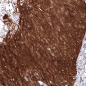 Anti-NCAM1 antibody produced in mouse Prestige Antibodies® Powered by Atlas Antibodies, clone CL12732, purified by using Protein A, buffered aqueous glycerol solution