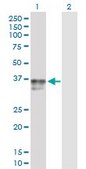 Anti-IGFBP3 antibody produced in rabbit purified immunoglobulin, buffered aqueous solution