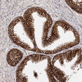 Anti-CTNNB1 antibody produced in rabbit Prestige Antibodies® Powered by Atlas Antibodies, affinity isolated antibody, buffered aqueous glycerol solution