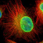 Anti-EMD antibody produced in rabbit Prestige Antibodies® Powered by Atlas Antibodies, affinity isolated antibody, buffered aqueous glycerol solution