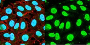 Anti-ZKSCAN3 (Zf47) from rabbit, purified by affinity chromatography