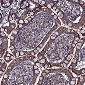 Anti-CCDC92 antibody produced in rabbit Prestige Antibodies® Powered by Atlas Antibodies, affinity isolated antibody, buffered aqueous glycerol solution