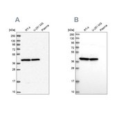 Anti-MRPS9 antibody produced in rabbit Prestige Antibodies® Powered by Atlas Antibodies, affinity isolated antibody, buffered aqueous glycerol solution