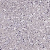 Anti-FSHB antibody produced in rabbit Prestige Antibodies® Powered by Atlas Antibodies, affinity isolated antibody