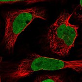 Anti-NUP50 antibody produced in rabbit Prestige Antibodies® Powered by Atlas Antibodies, affinity isolated antibody