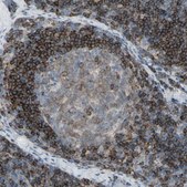 Anti-CD79B antibody produced in rabbit Prestige Antibodies® Powered by Atlas Antibodies, affinity isolated antibody, buffered aqueous glycerol solution