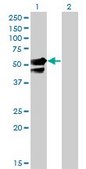 Monoclonal Anti-AAK1 antibody produced in mouse clone 4B10, purified immunoglobulin, buffered aqueous solution