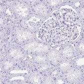 Anti-TNNT1 antibody produced in rabbit Prestige Antibodies® Powered by Atlas Antibodies, affinity isolated antibody, buffered aqueous glycerol solution