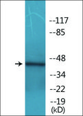 Anti-phospho-p53 (pSer392) antibody produced in rabbit affinity isolated antibody
