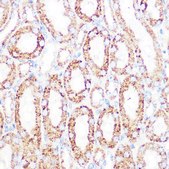 Anti-DLDH/DLD antibody produced in rabbit