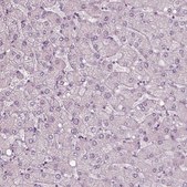 Anti-RSPH9 antibody produced in rabbit Prestige Antibodies® Powered by Atlas Antibodies, affinity isolated antibody, buffered aqueous glycerol solution