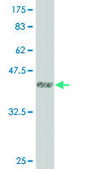 Monoclonal Anti-LMTK3 antibody produced in mouse clone 2H6, purified immunoglobulin, buffered aqueous solution