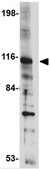 Anti-SAPAP2 Antibody from rabbit, purified by affinity chromatography