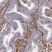 Anti-ITIH1 antibody produced in rabbit Prestige Antibodies® Powered by Atlas Antibodies, affinity isolated antibody, buffered aqueous glycerol solution