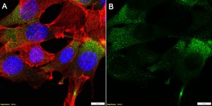 Anti-CHRNA1/ACHRA Antibody, clone 2G22 ZooMAb® Rabbit Monoclonal recombinant, expressed in HEK 293 cells