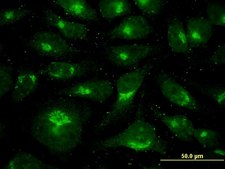Monoclonal Anti-USO1 antibody produced in mouse clone 3F4, purified immunoglobulin, buffered aqueous solution