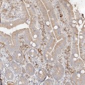 Anti-TRANK1 antibody produced in rabbit Prestige Antibodies® Powered by Atlas Antibodies, affinity isolated antibody, buffered aqueous glycerol solution