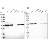 Anti-EIF3I antibody produced in rabbit Prestige Antibodies® Powered by Atlas Antibodies, affinity isolated antibody, buffered aqueous glycerol solution, ab1