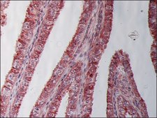 Monoclonal Anti-β-Tubulin I antibody produced in mouse clone SAP.4G5, ascites fluid