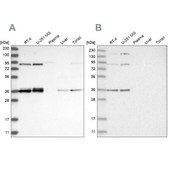Anti-WRNIP1 antibody produced in rabbit Prestige Antibodies® Powered by Atlas Antibodies, affinity isolated antibody, buffered aqueous glycerol solution