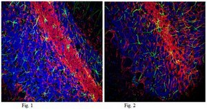 Anti-Neurofilament 200kDa Antibody, clone NE14, Alexa Fluor™ 555 Conjugate clone NE14, from mouse, ALEXA FLUOR™ 555