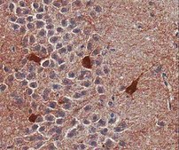 Anti-GABAA Receptor α1 Antibody Upstate®, from rabbit