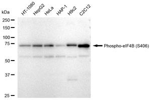 KD-Validated Anti-phospho-eIF4B (Ser406) Antibody, clone 23GB3905, Rabbit Monoclonal clone 23GB3905, recombinant rabbit monoclonal, expressed in HEK293 cells